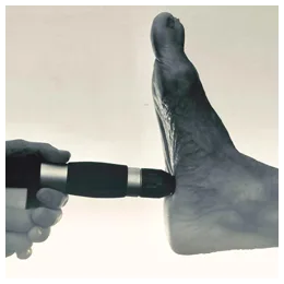 Shockwavetoestel wordt met de handapplicator op de voetzool van een patiënt geplaatst